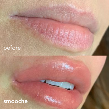 Extreme Lip Plumper 2
